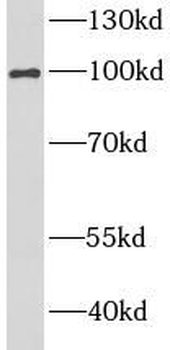 PMS2 Rabbit Polyclonal Antibody