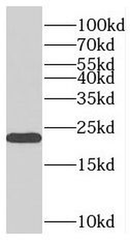 PMVK Antibody