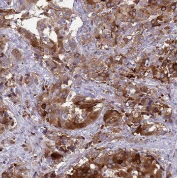 PNKD Antibody