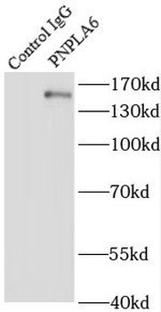 PNPLA6 Rabbit Polyclonal Antibody
