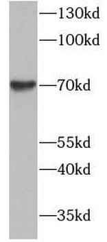 PODN Antibody