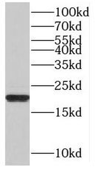 MED16 Antibody