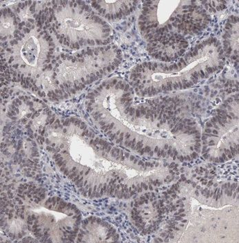 POLR2F Rabbit Polyclonal Antibody