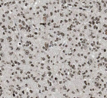 POLR3K Rabbit Polyclonal Antibody