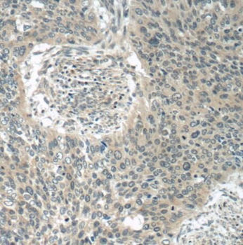 POM121 Rabbit Polyclonal Antibody