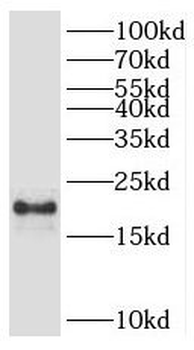 POP7 Antibody