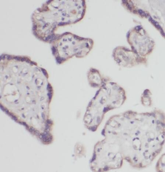 POPDC3 Rabbit Polyclonal Antibody
