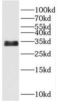 PPA1 Rabbit Polyclonal Antibody