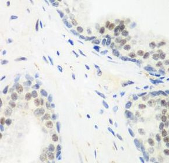 PPAN Rabbit Polyclonal Antibody