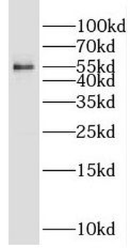 PPARG Rabbit Polyclonal Antibody