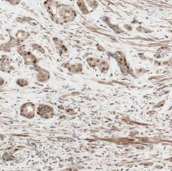 PPARG Rabbit Polyclonal Antibody