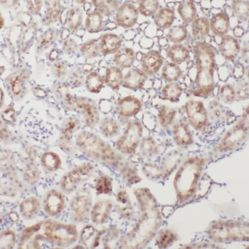 PPCS Rabbit Polyclonal Antibody