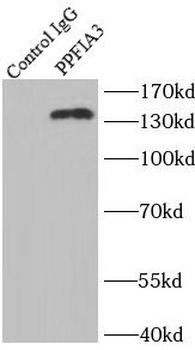 PPFIA3 Rabbit Polyclonal Antibody