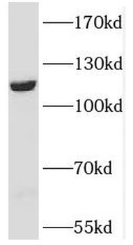 PPFIBP1 Antibody