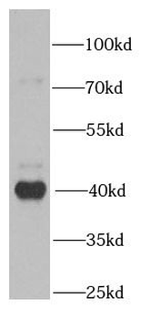 PPID Rabbit Polyclonal Antibody