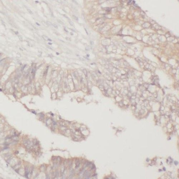 PPIL1 Rabbit Polyclonal Antibody