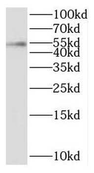 PPM1B Antibody
