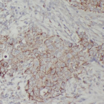 PPM1B Rabbit Polyclonal Antibody