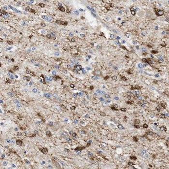 PPM1K Rabbit Polyclonal Antibody