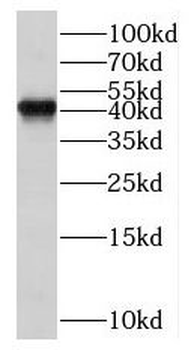 PPM1L Rabbit Polyclonal Antibody