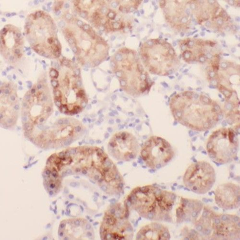 PPM1L Rabbit Polyclonal Antibody