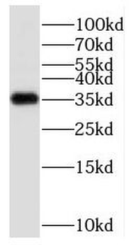 PPP1CC Antibody
