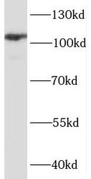 PPP1R12B Antibody
