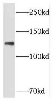 PPP1R9B Rabbit Polyclonal Antibody