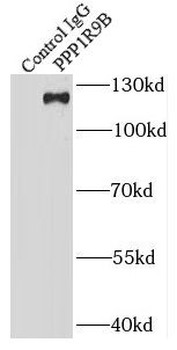 PPP1R9B Rabbit Polyclonal Antibody