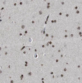 PPP1R9B Rabbit Polyclonal Antibody