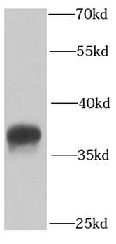 PPP2CA Rabbit Polyclonal Antibody