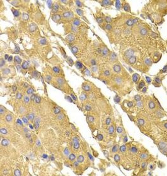 PPP2CA Rabbit Polyclonal Antibody