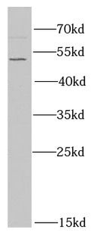 PPP2R2A Antibody