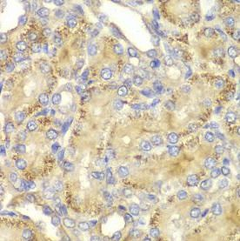 PPP2R2A Rabbit Polyclonal Antibody