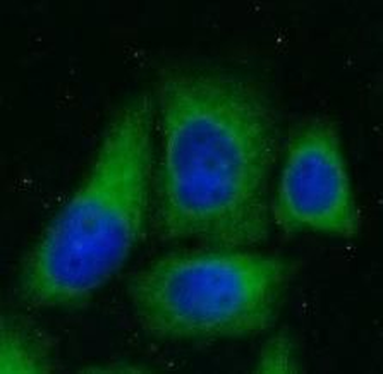PPP2R2B Rabbit Polyclonal Antibody