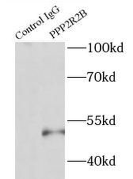 PPP2R2B Rabbit Polyclonal Antibody