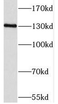 PPP2R3A Antibody