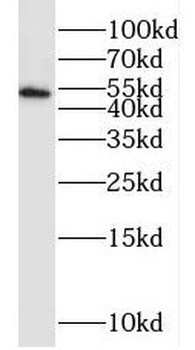 PPP2R3C Rabbit Polyclonal Antibody