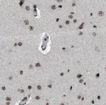 PPP2R3C Rabbit Polyclonal Antibody