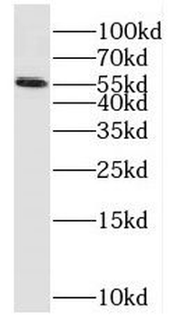 PPP2R5A Antibody