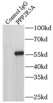 PPP2R5A Rabbit Polyclonal Antibody