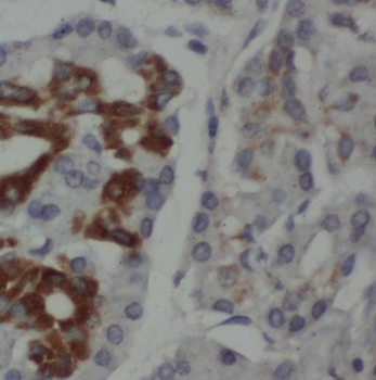 PPP2R5A Rabbit Polyclonal Antibody