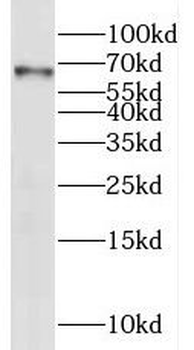 PPP4R2 Rabbit Polyclonal Antibody
