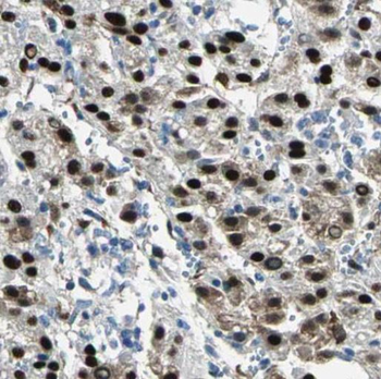 PPP4R2 Rabbit Polyclonal Antibody