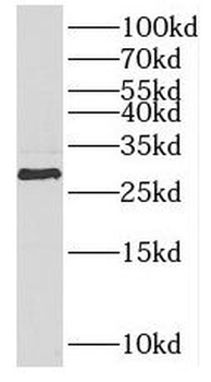 PPT2 Antibody