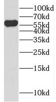PRAME Antibody