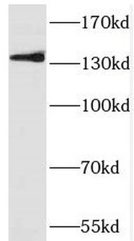 PRDM10 Antibody