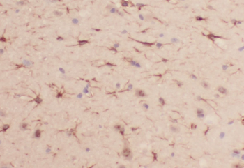 PRDX6 Rabbit Polyclonal Antibody