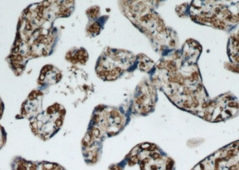 PZP Rabbit Polyclonal Antibody