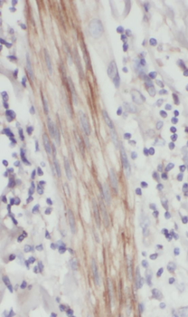 PRELID1 Antibody